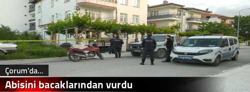 Abisini bacaklarından vurdu