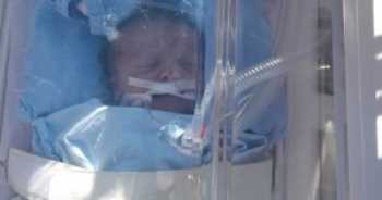 Bugün dünya’ya gelen bebek için  hava ambulansı geldi