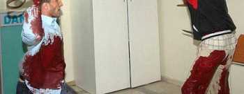 Çorum'da Husumetlisi, Tedavi Gördüğü Hastanede Bıçakladı