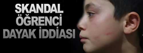 Çorum'da Öğrenciye Dayak İddiası!