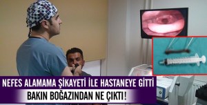 Nefes almakta zorlanan hastanın boğazından 12 santimetrelik sülük çıkarıldı