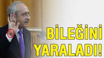 Kürsüye vurarak konuşan Kılıçdaroğlu elini yaraladı