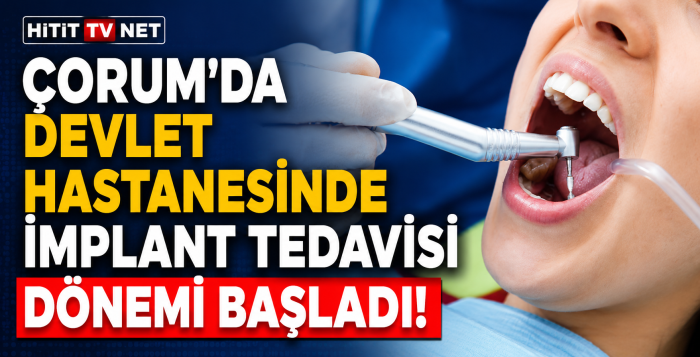 Çorum'da Devlet Hastanesinde İmplant Tedavisi Dönemi Başladı!
